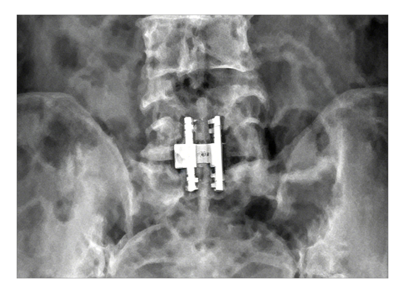 Imaging friendly