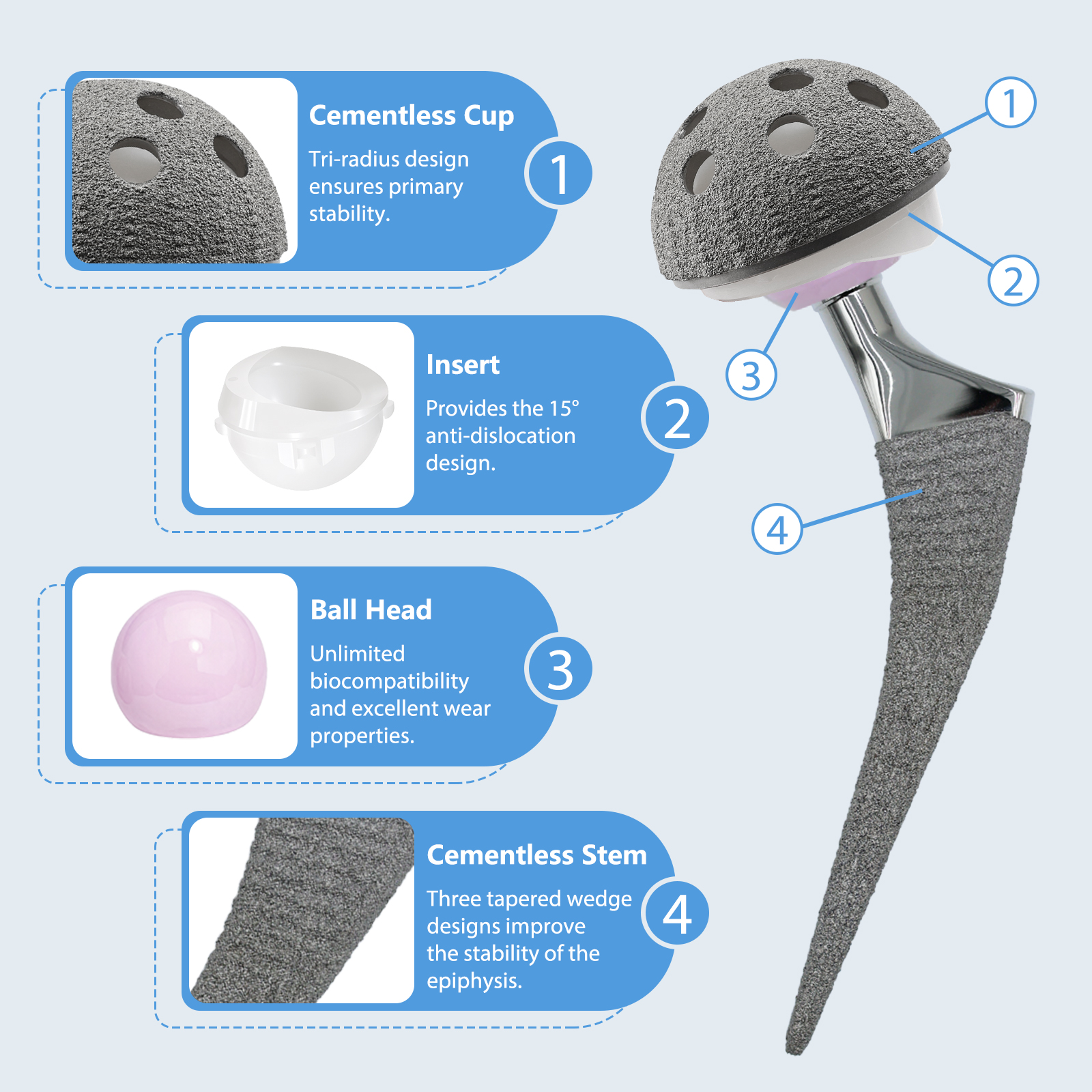 Advanced Geasure Cementless Anatomical Hip Joint Replacement Fracture Fixation Titanium HA Double Coating Class III Implants
