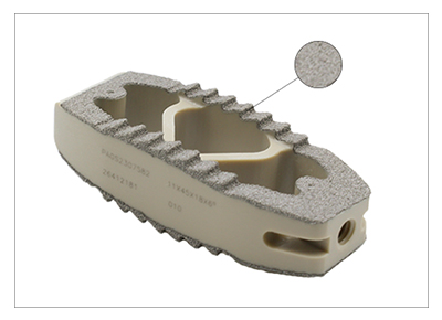 Osseointegration feature