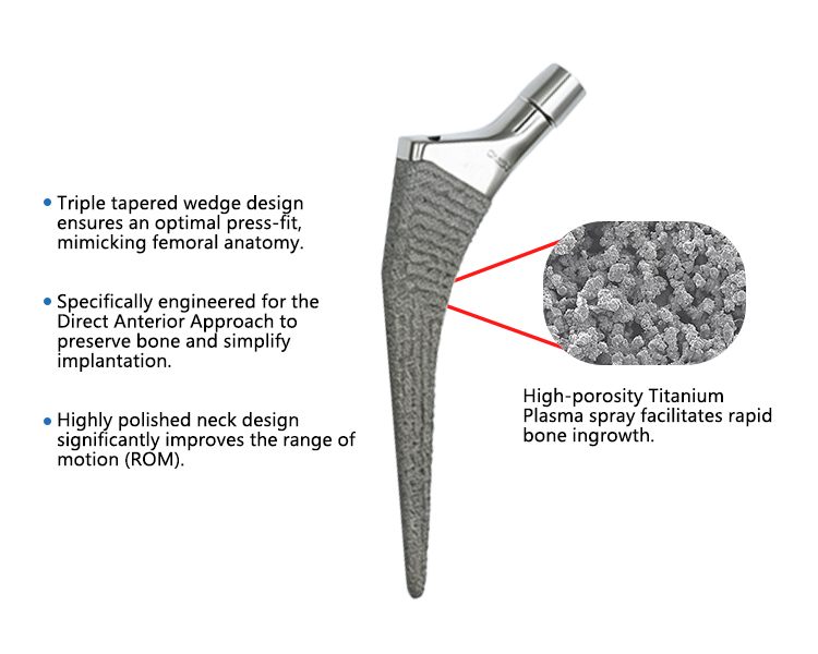 Professional Medical Grade Anatomical Cementless Hip System Total Hip Replacement Surgical Implants Titanium HA Coating Geasure