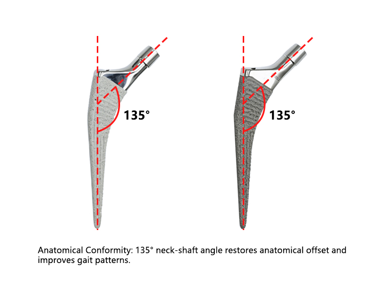 Professional Medical Grade Anatomical Cementless Hip System Total Hip Replacement Surgical Implants Titanium HA Coating Geasure