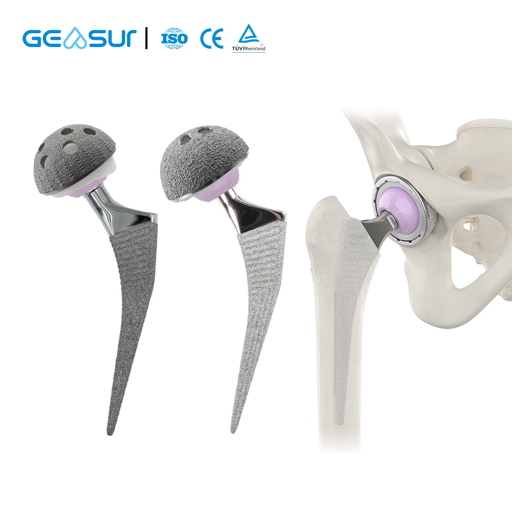 High Quality Geasure Cementless Anatomical Hip Prosthesis Plasma Sprayed Titanium Coating for Total Hip Arthroplasty Class III