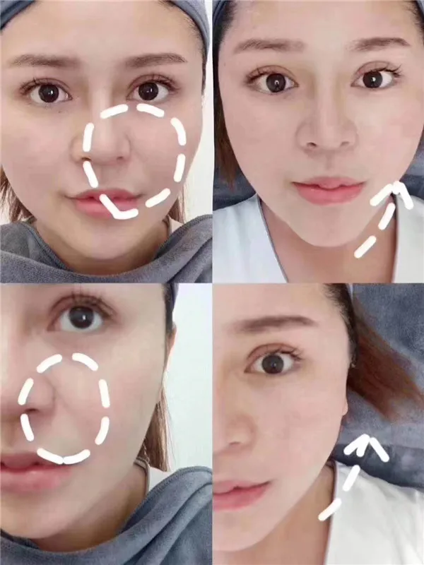 Before and After Result