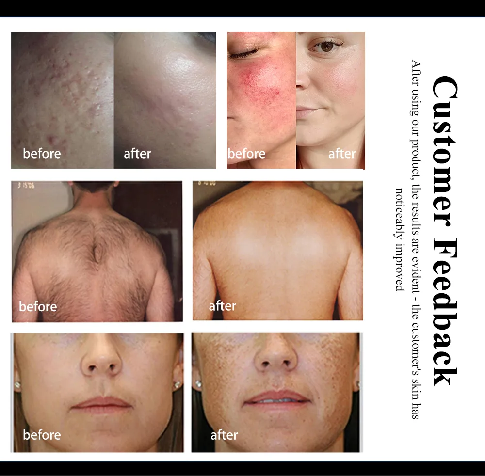 DPL Machine Detail 1