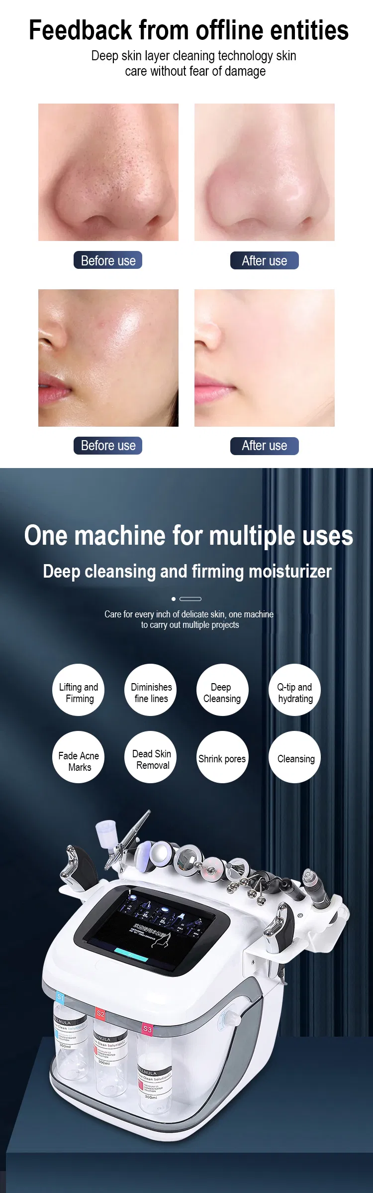 Facial Machine View 4