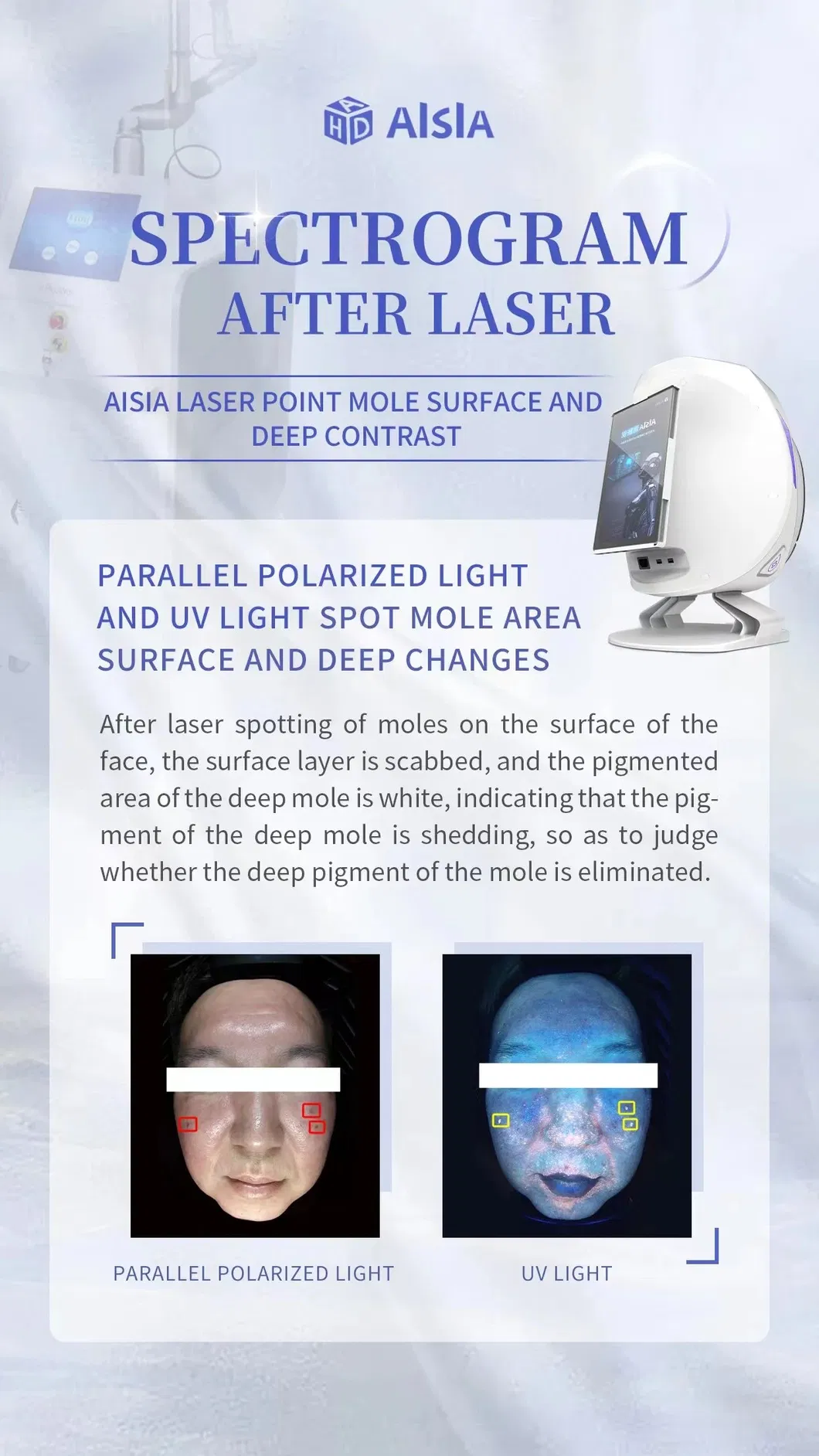 Skin Analyzer View 4