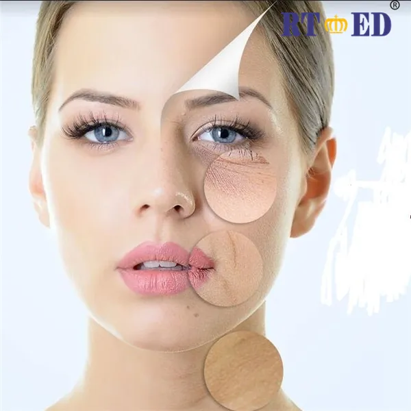 Pdo Pcl Plla Threads