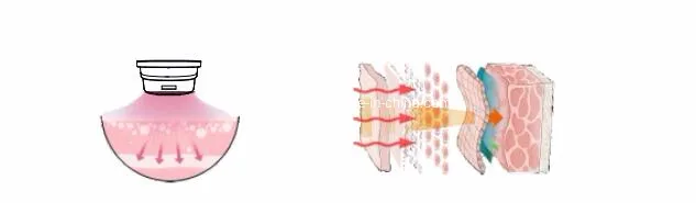 Red Light Principle Diagram