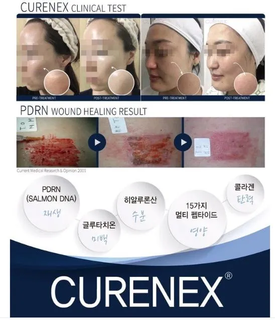 Curenex Skin Booster