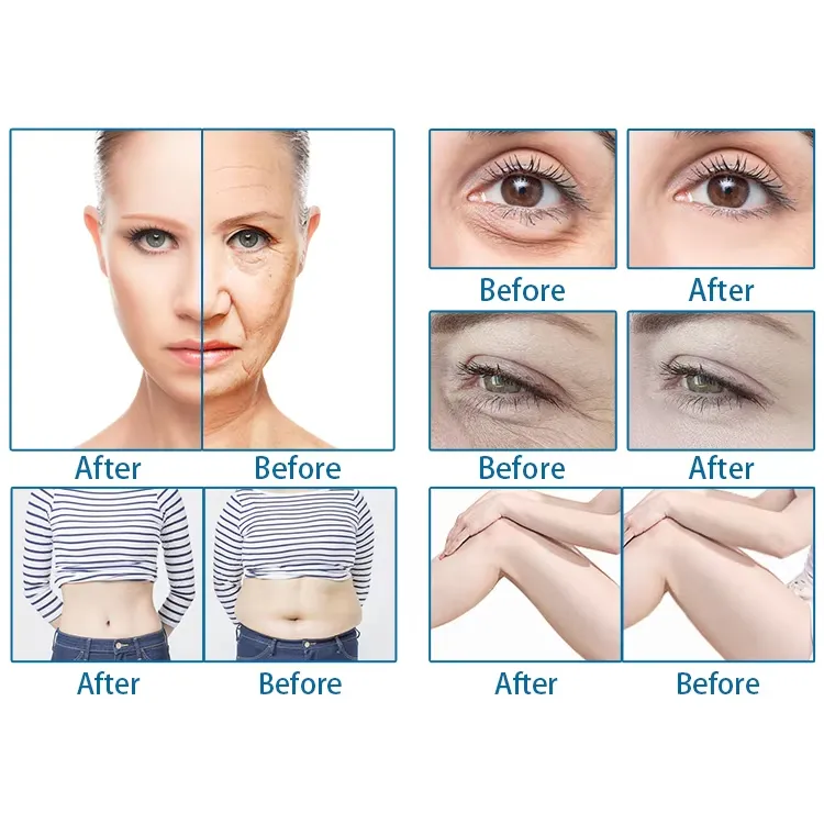 Before and After Results