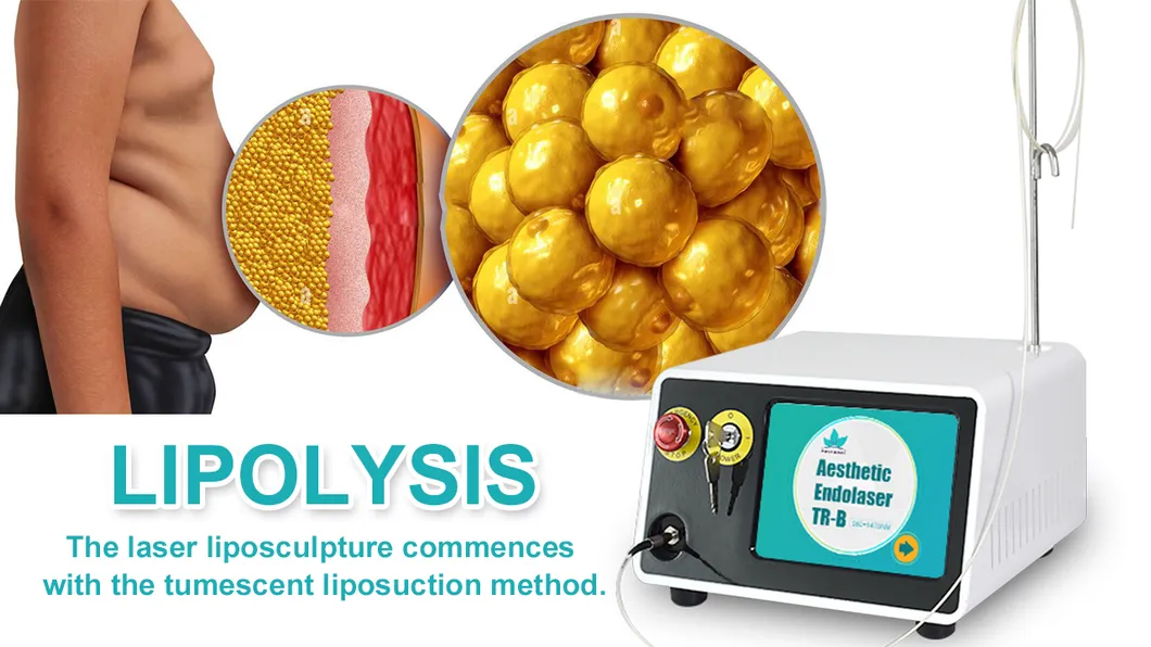 Laser Facelift Device