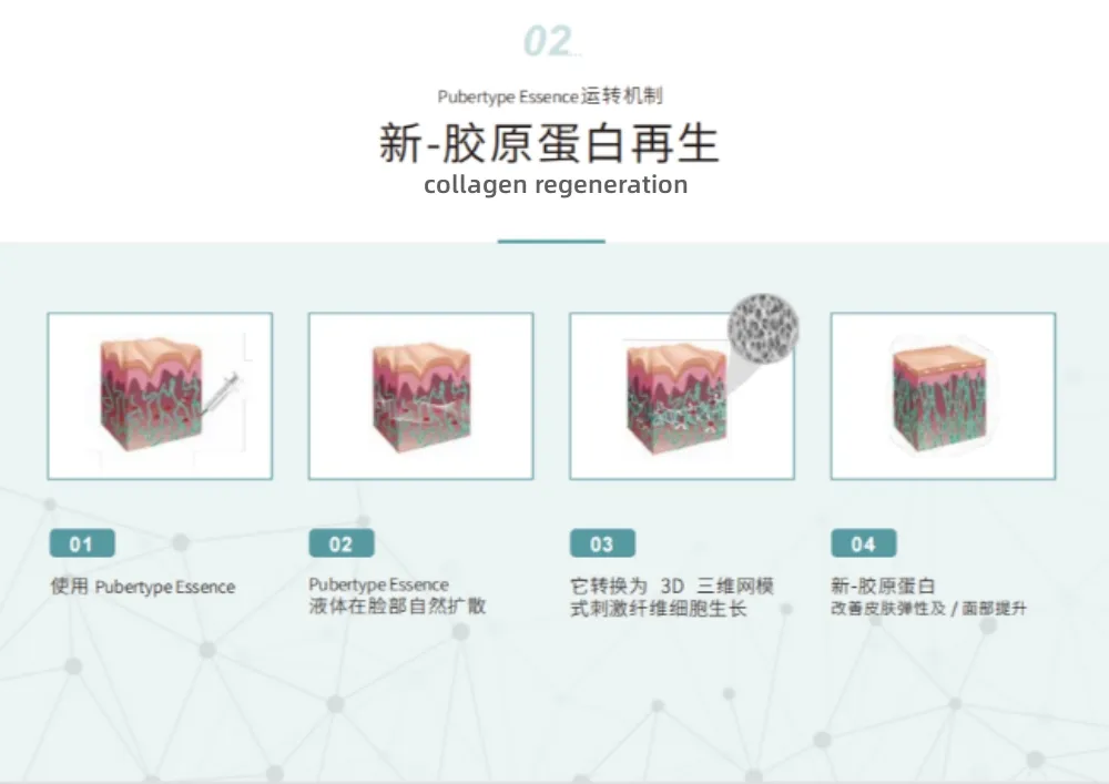 Face Lifting Injection