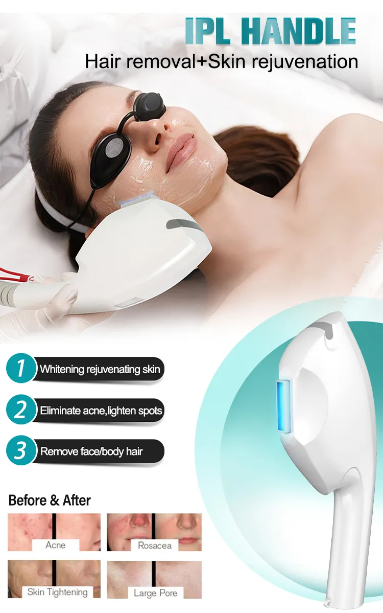 808nm Hair Removal Machine 6