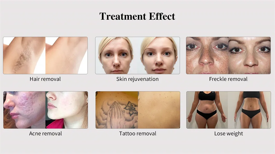 Before and After Results