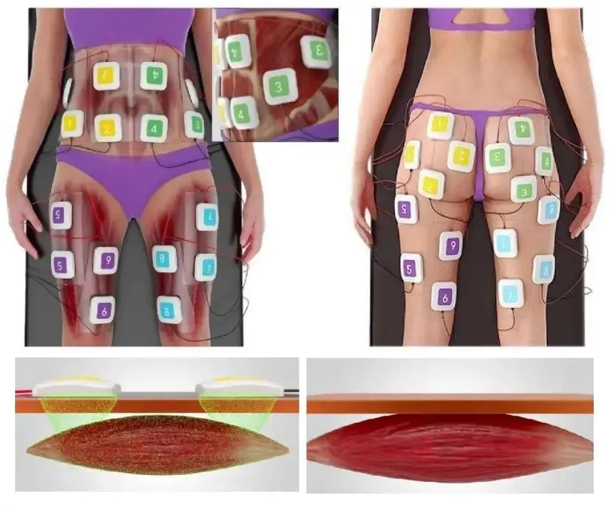 EMS Treatment Process
