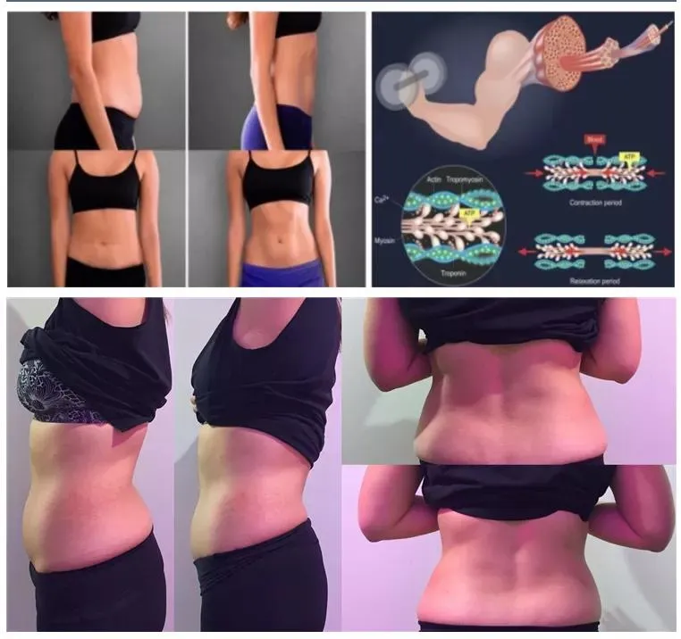 Before and After Results