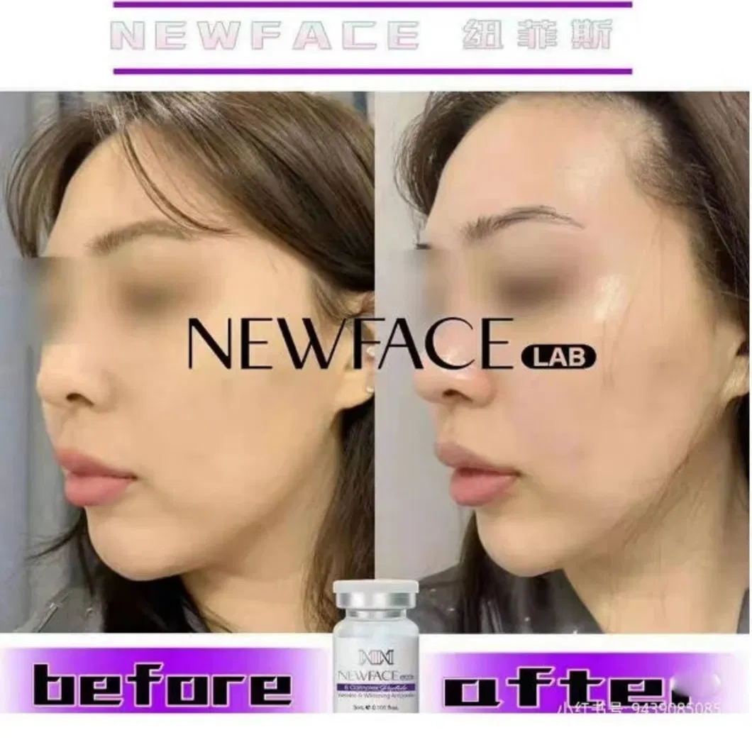 Newface Lab Skinbooster 3