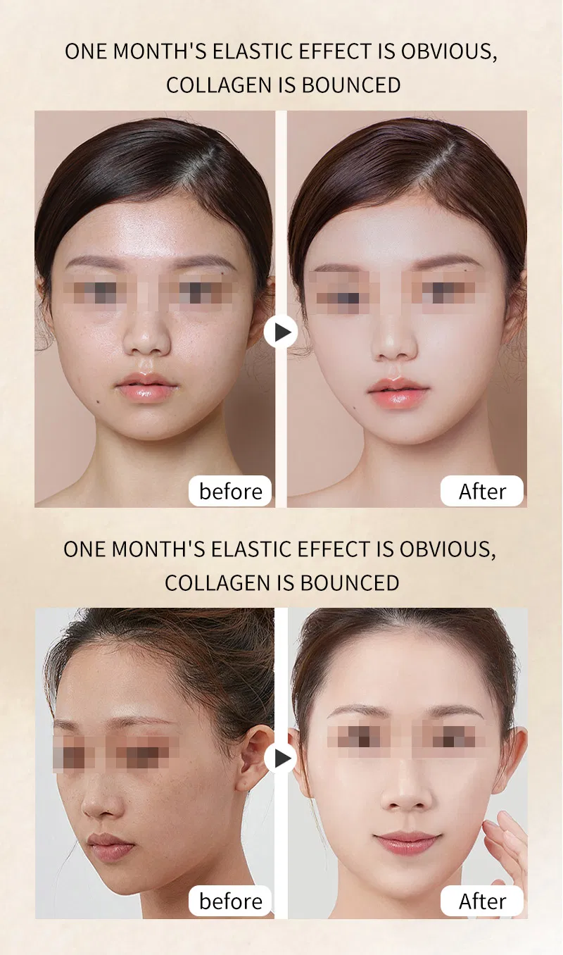 Skin Care Beauty Device 6