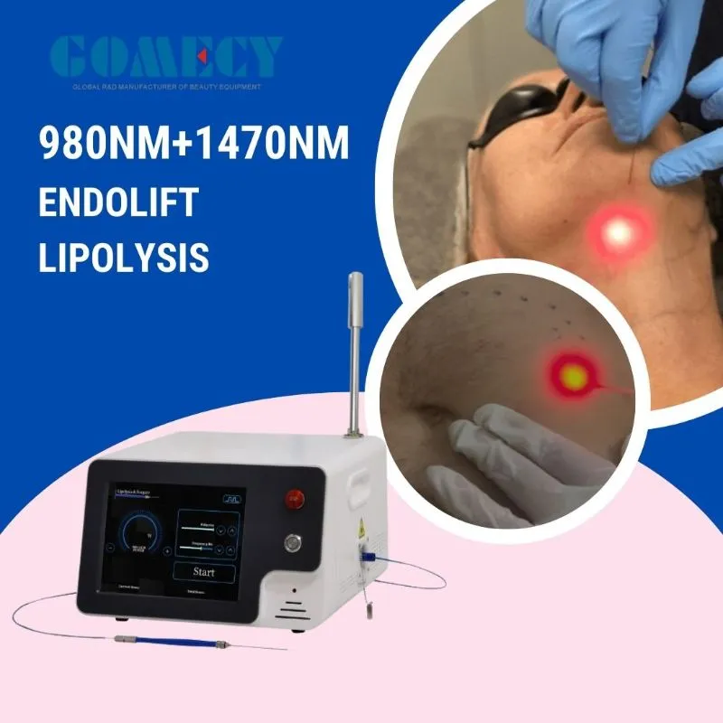 Laser Equipment Overview