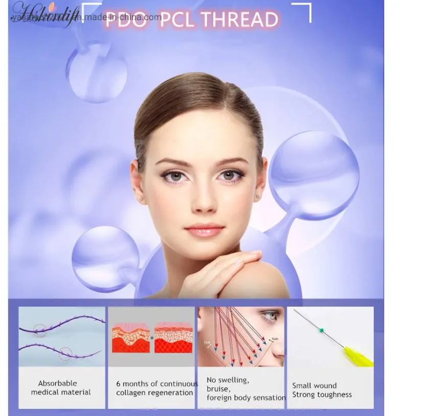 Fishbone Cog Lifting Threads