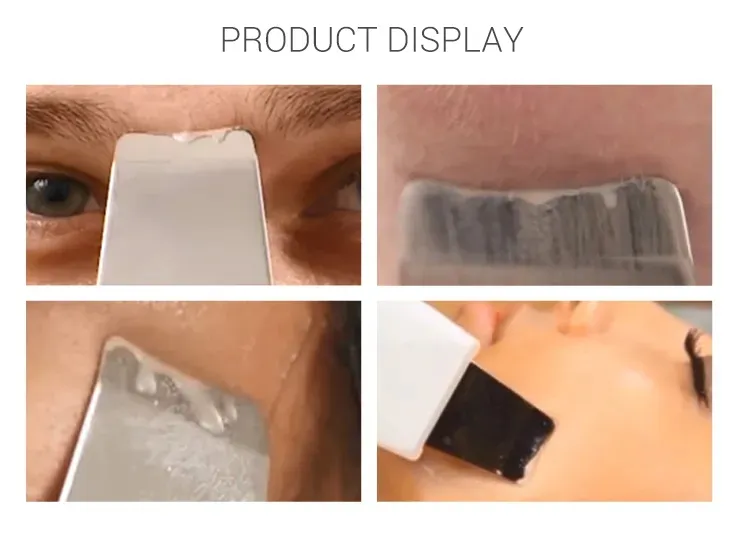 Skin Scrubber View 6