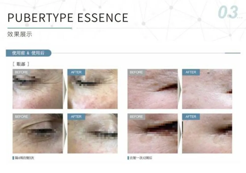 Professional Skin Care