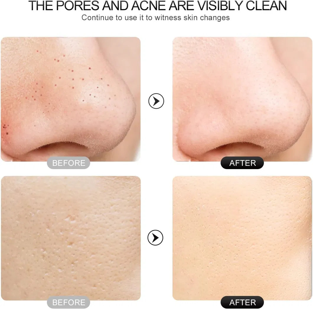 Deep Cleaning Results