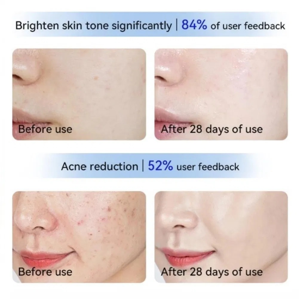 Professional Light Therapy