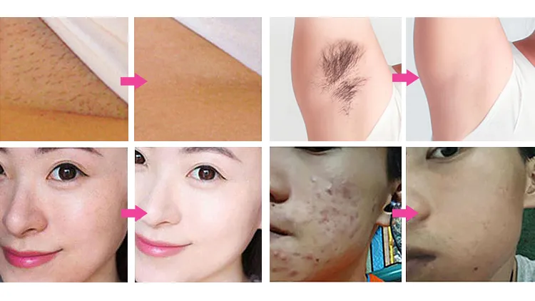 Before and After Results