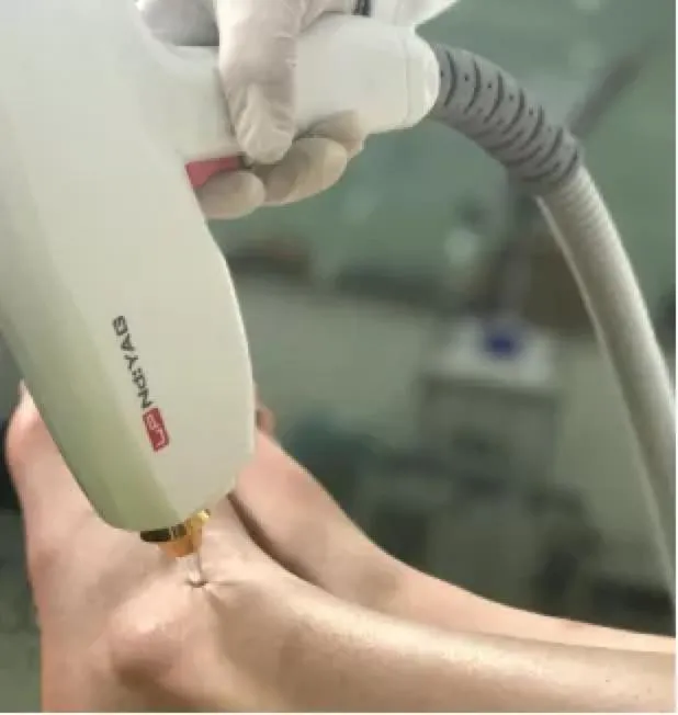 Internal Component 2