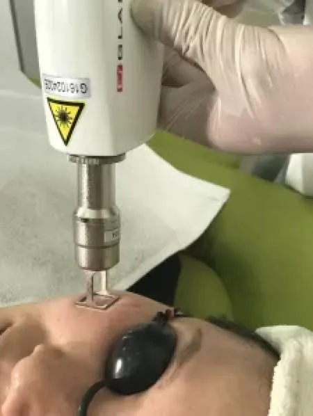 Internal Component 3