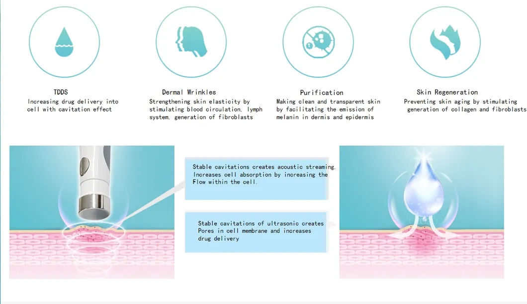 Sono Poration Effect