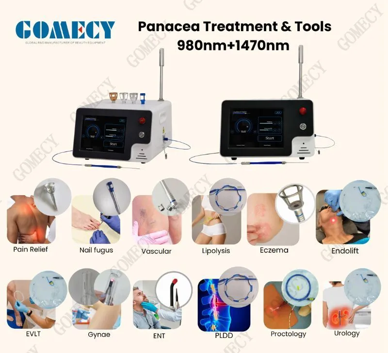 Laser Surgery Applications