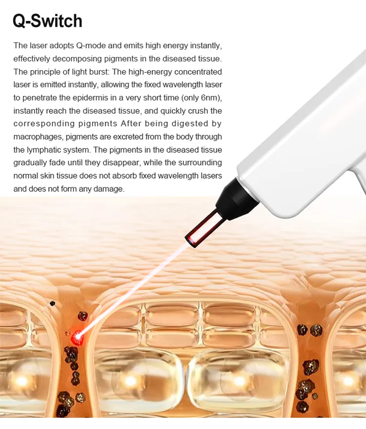 808nm Hair Removal Machine 3