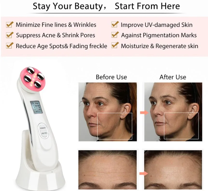 RF Facial Device View 4