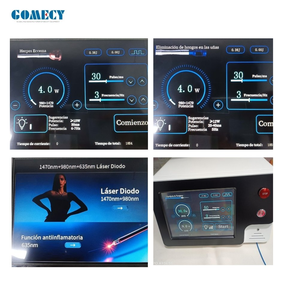 30W Powerful 980nm 1470nm Laser Evlt Hemorrhoids Lipolysis Face Endolifting Laser