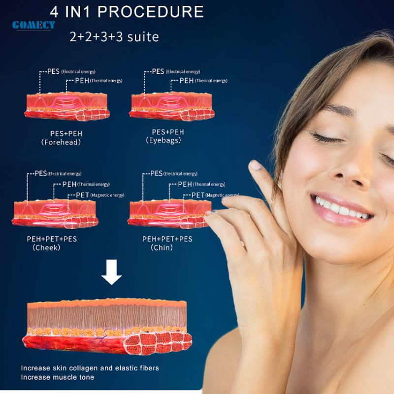 Facial Skin Firming Lifting Beauty Wholesale Wrinkle Remover Neck Lift Device