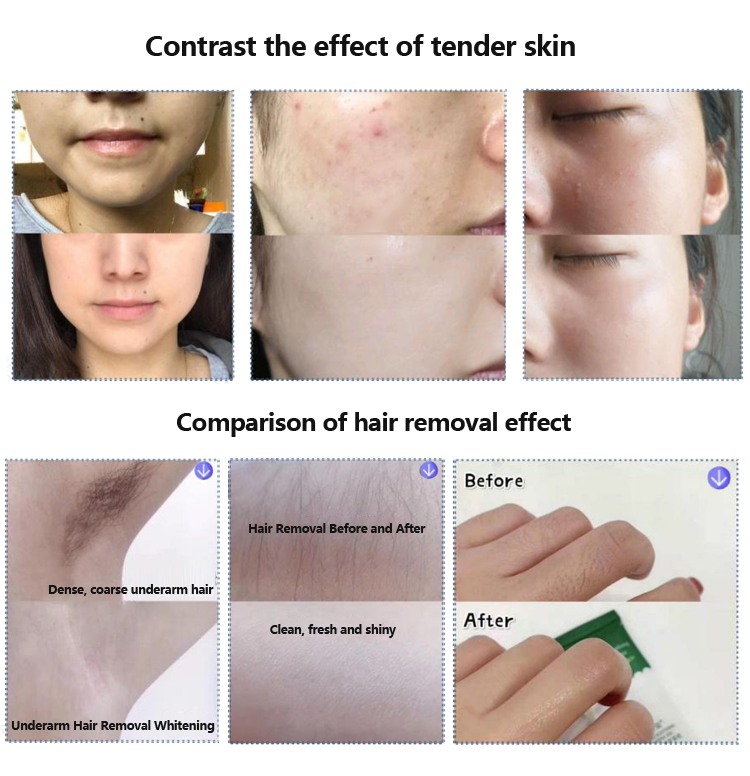 M22 Multi-Functio M22 IPL Machine Desktop Beauty Machine for Skin Care Tattoo Remover &amp; Skin Rejuvenation Machine for Home Laser Hair Removal Machine