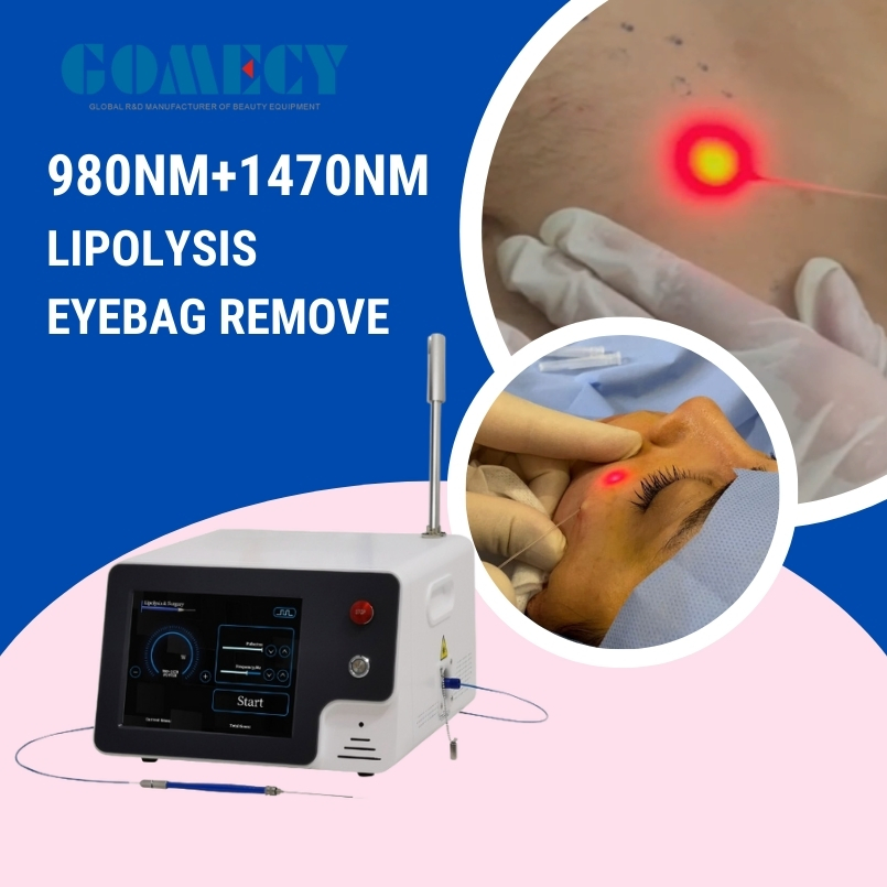 980nm Lipolysis 1470nm Endolift Laser Evlt Lipolysis Double Chin Body Beauty Equipment