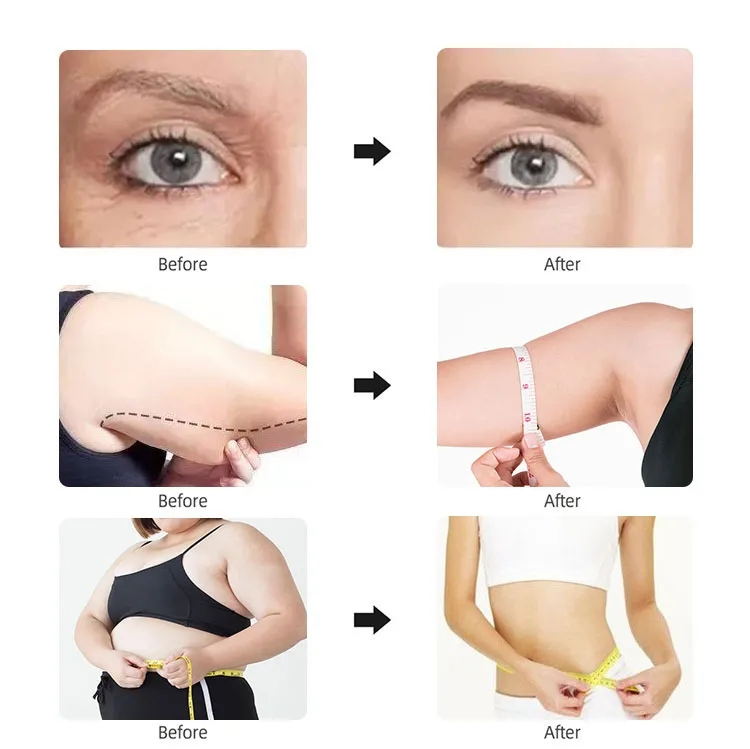 Mini Radio Frequency Facial Skin Lifting Firming Smooth Wrinkle Whiten Home Use Salon 2in1 RF Beauty Device