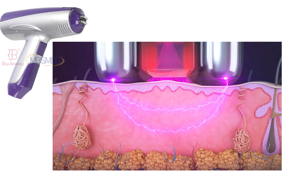 Facial Wrinkle Remover Inmode Morpheus 8 Radio Frequency Fractionated RF Skin Tightening Device