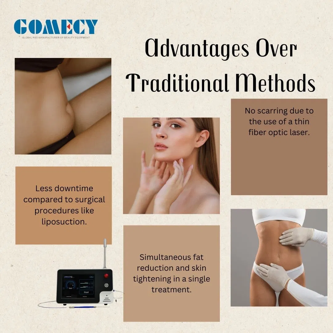 20W 30W Powerful 980nm 1470nm Laser Endolifting Double China Shape Surgery Equipment