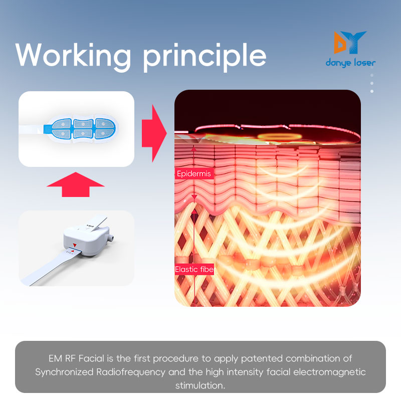 Radio Frequency Electromagnetic Face Shaping and Tightening Device EMS RF Lifting Facial Sculpting Machine