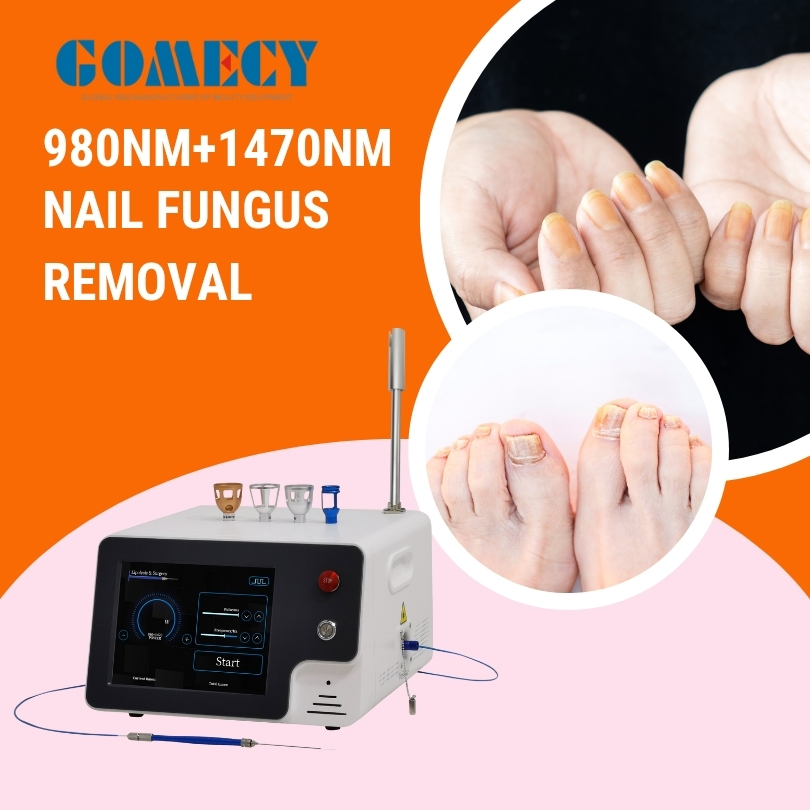 Gomecy 980nm 1470nm Laser for Face Lifting Evlt Lipolysis Medical Skin Beauty
