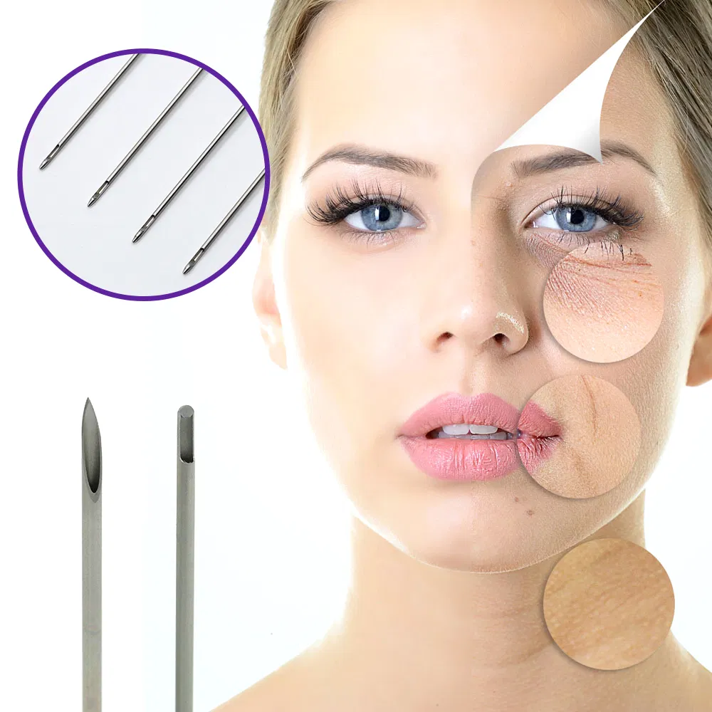 Pdo Thread Lift Cog 6D 12D for Face Neck Lifting and Wrinkle Removal OEM ODM