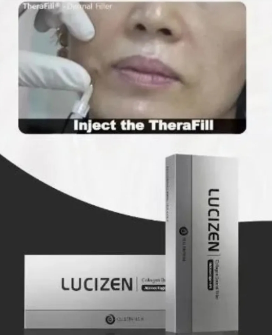 High-Quality Hyaluronic Acid Gel Lucizen Injection Improves Skin Dimpling, Wrinkle Removal, Anti-Aging, and Face Lifting