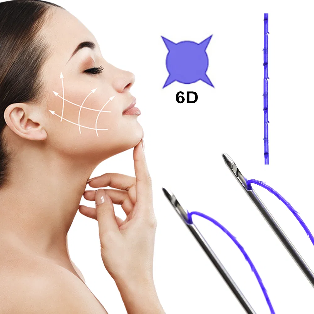 Korea Pdo Lifting Thread Absorbable Surgical Suture for Face Lifting and Skin Tightening Beauty Treatment