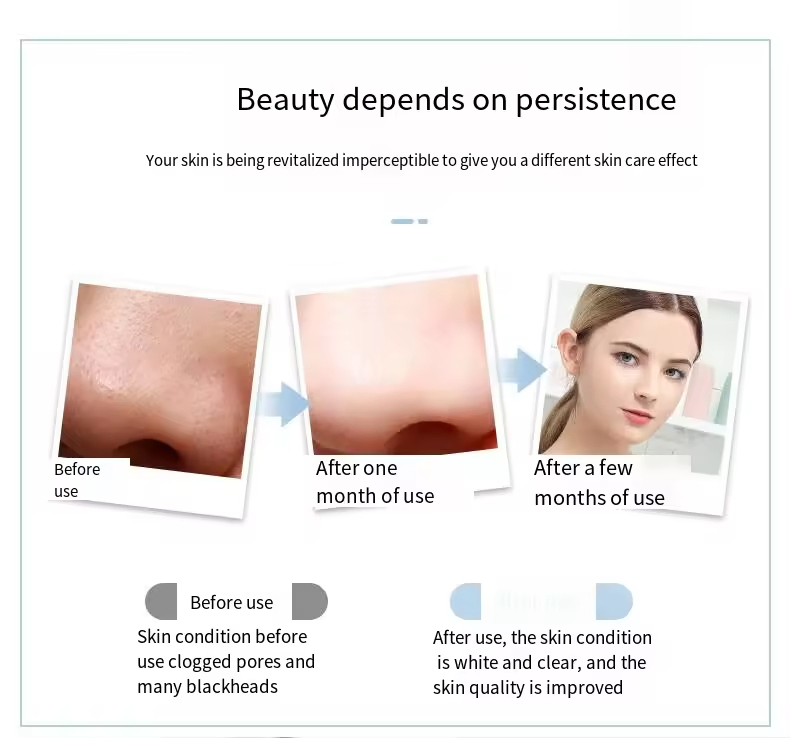 Ultrasonic Facial Scrubber Deep Cleaning Portable Stock Facial Beauty Device Lightening Brightening Skin