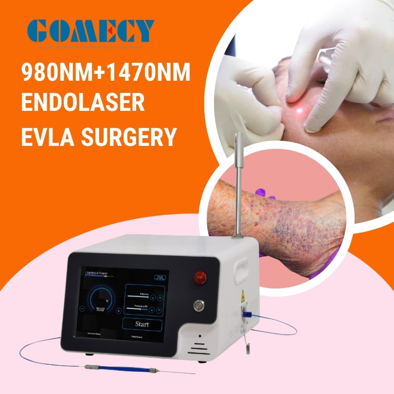 1470nm Laser Surgery Equipment Evlt 980nm 1470nm Endolift Laser Equipment Face Shaping