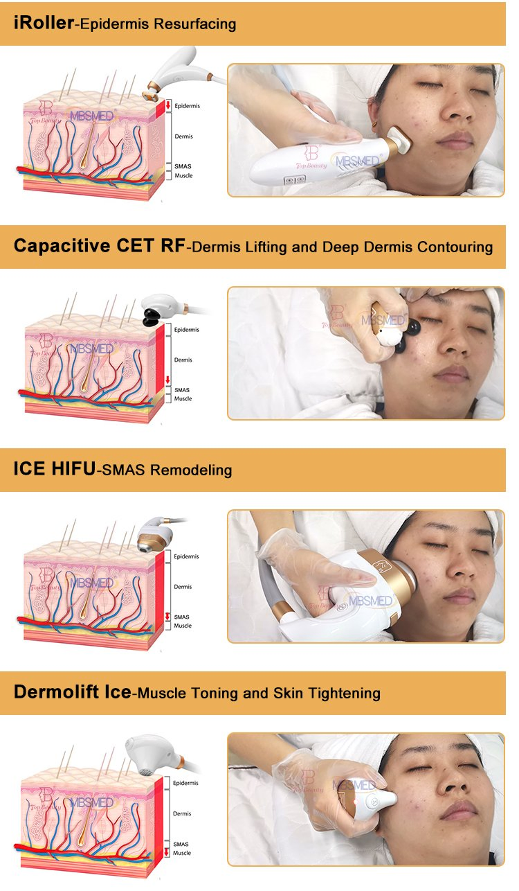Hifu Ice Facial Lifting Skin Tightening High Intensity Focused Ultrasound Device